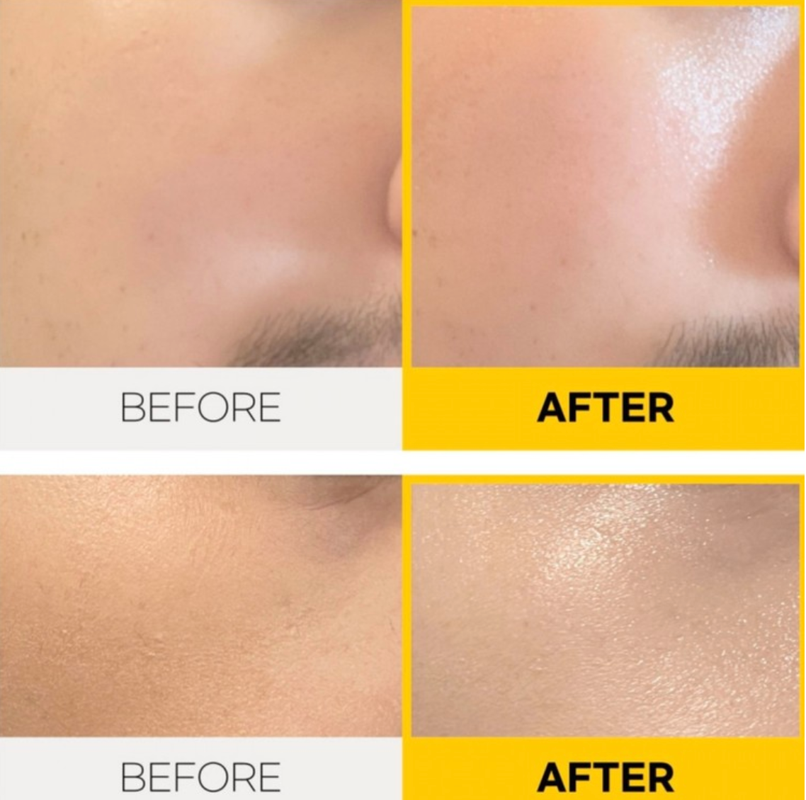 Close-up comparison of skin before and after using the Functional Iron Stick Light Mini, showcasing smoother and more radiant skin